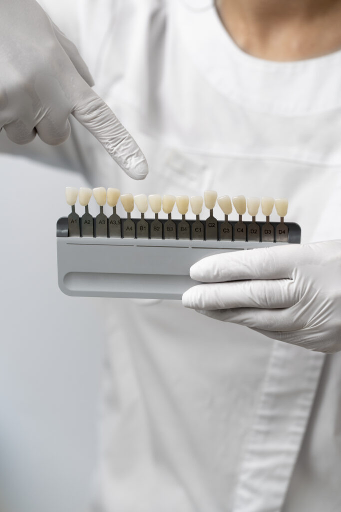 A dentist showing a collection of veneers