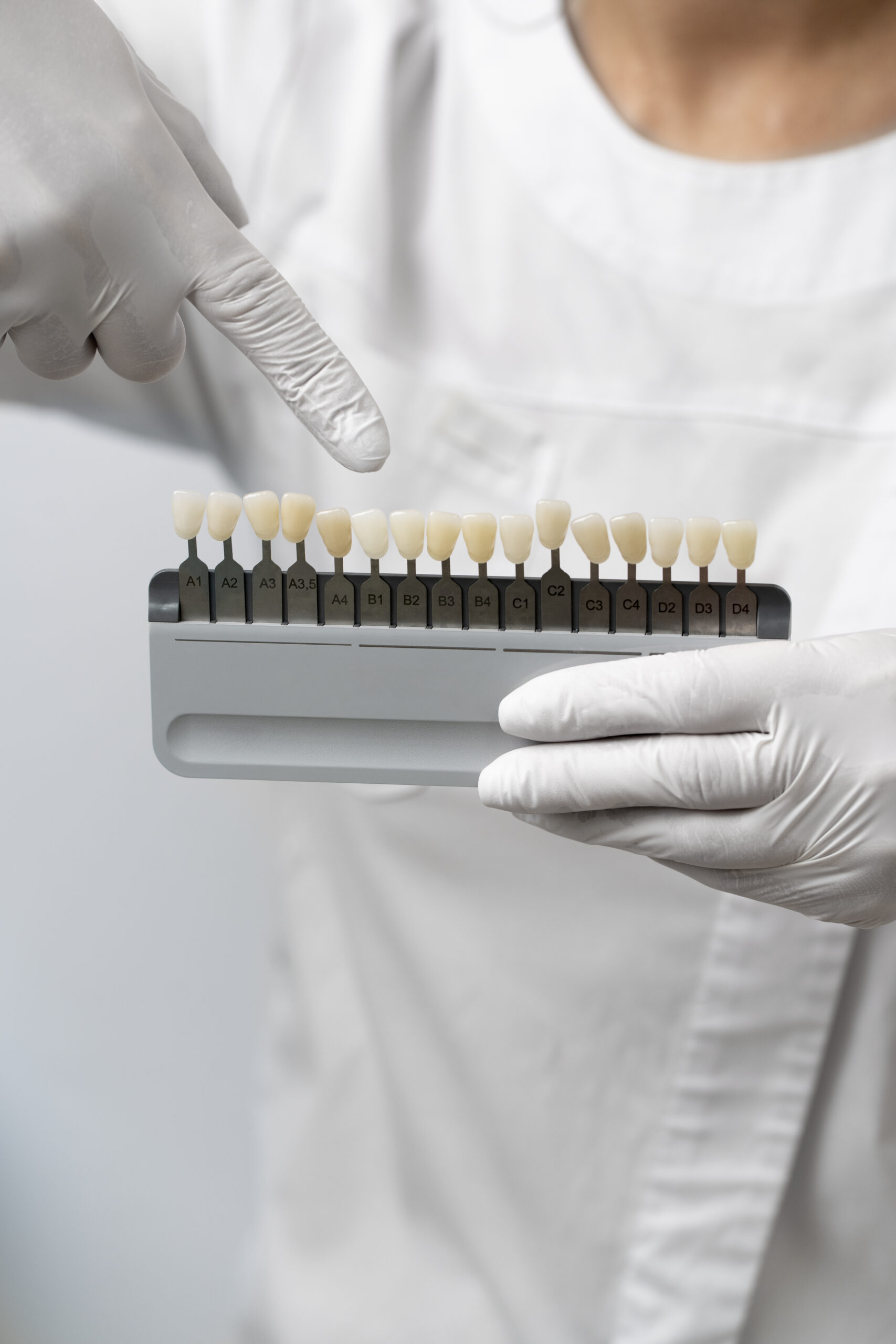 A dentist showing a collection of veneers