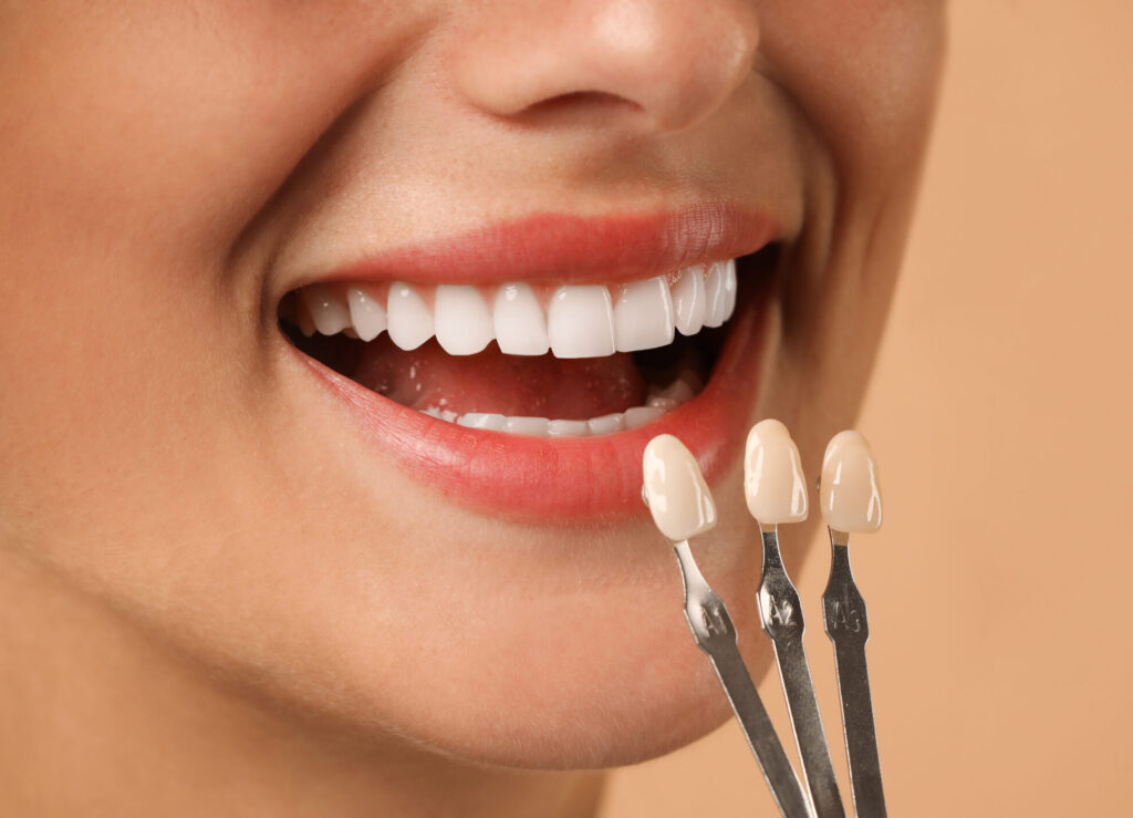 A doctor working on dental veneers in Paradise, NV and a smiling woman