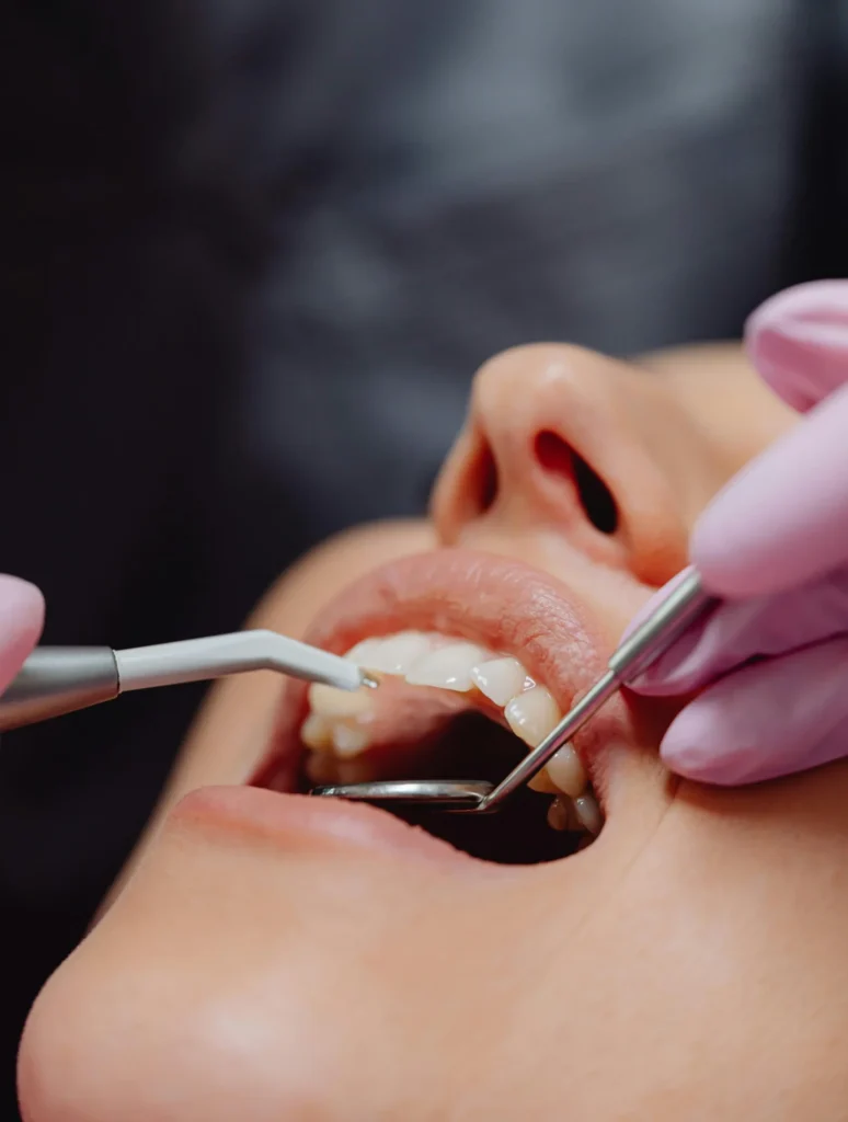 At Care for You Dental clinic, a dentist and a beautiful girl patient are undergoing the tooth extraction process