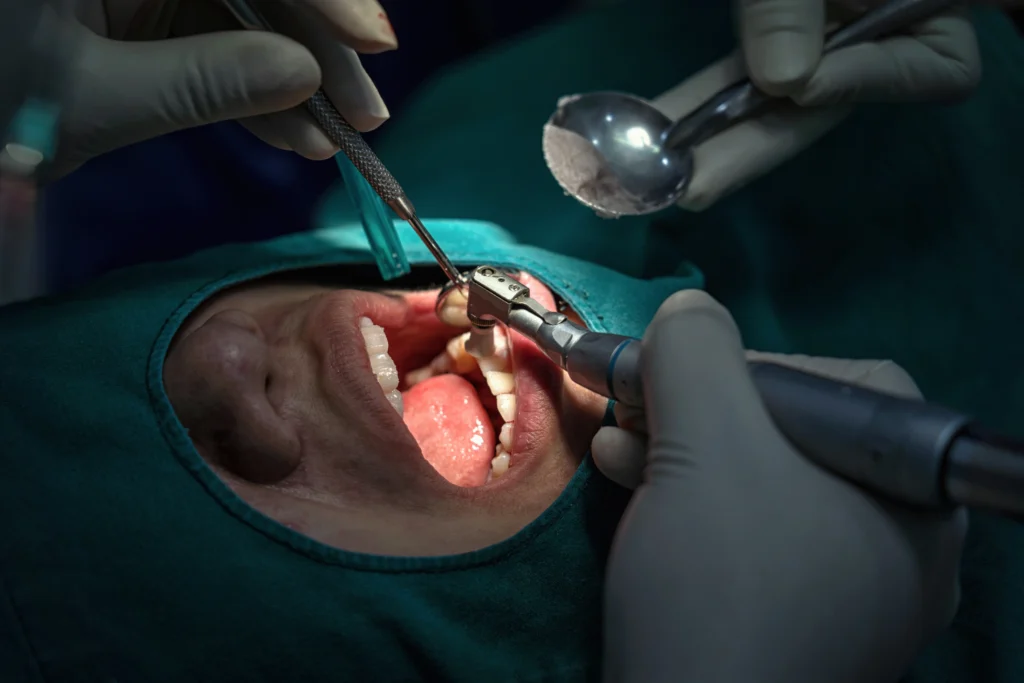 At Care for You Dental clinic, a dentist and a male patient are undergoing the tooth extraction process