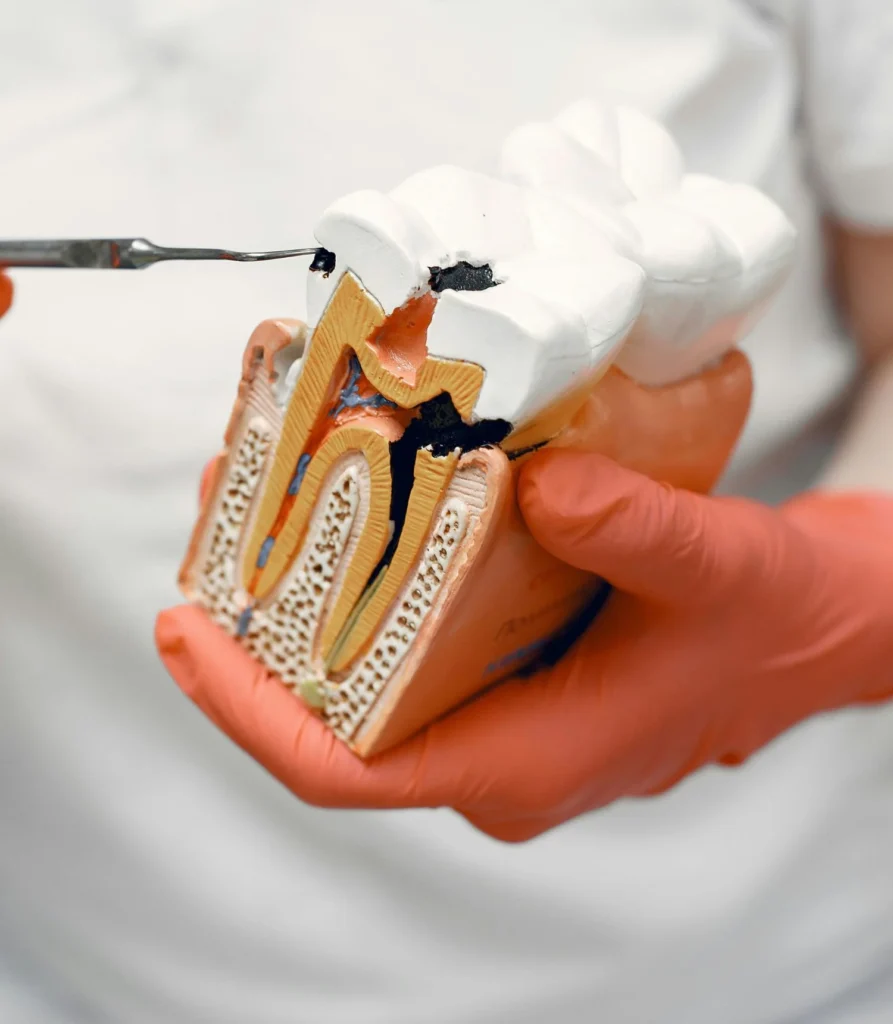 Dentist showing a sample illustration of teeth and root canal treatment
