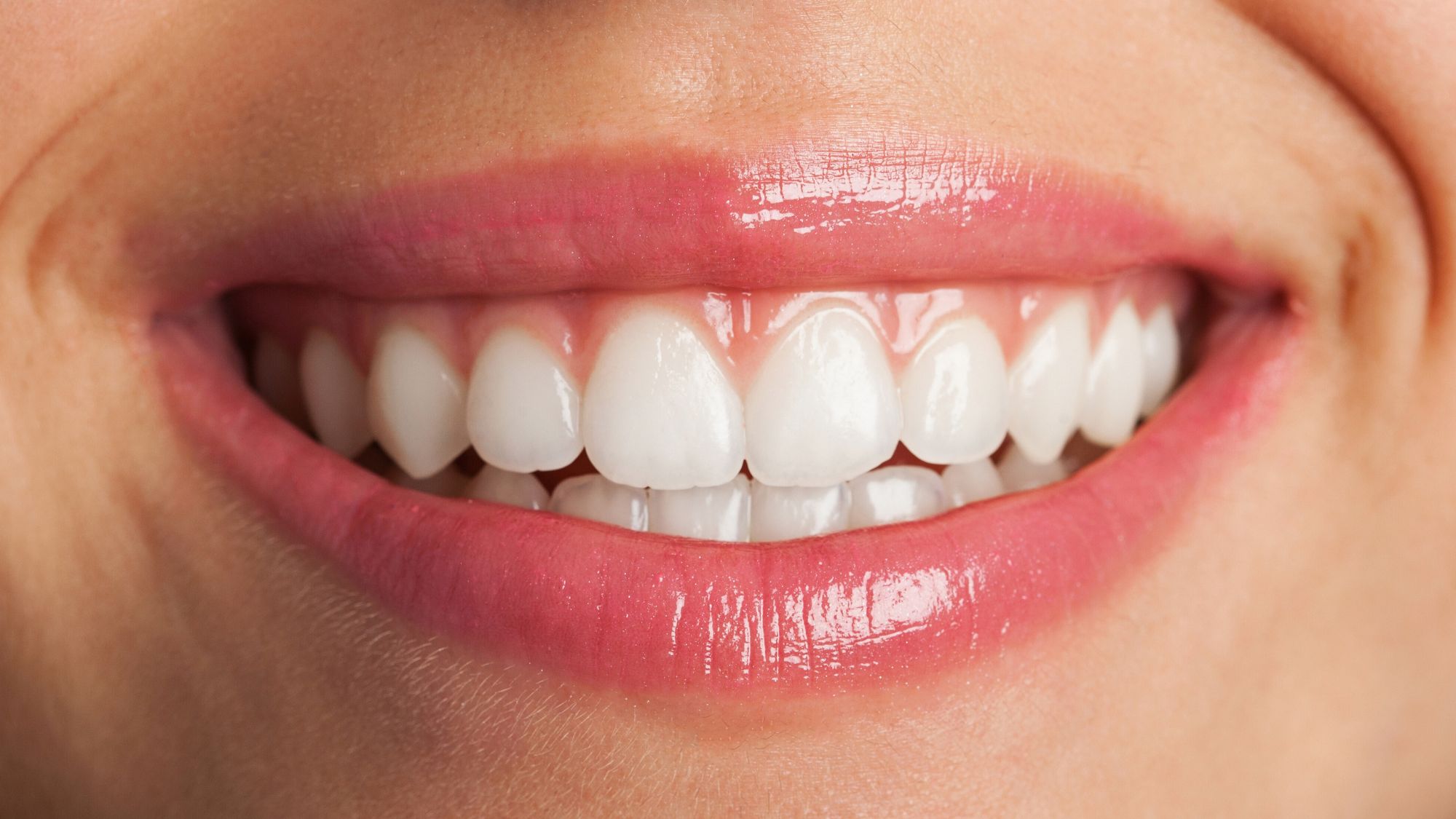 Close-up of a beautiful smile with perfectly white teeth, showcasing the results of professional teeth whitening